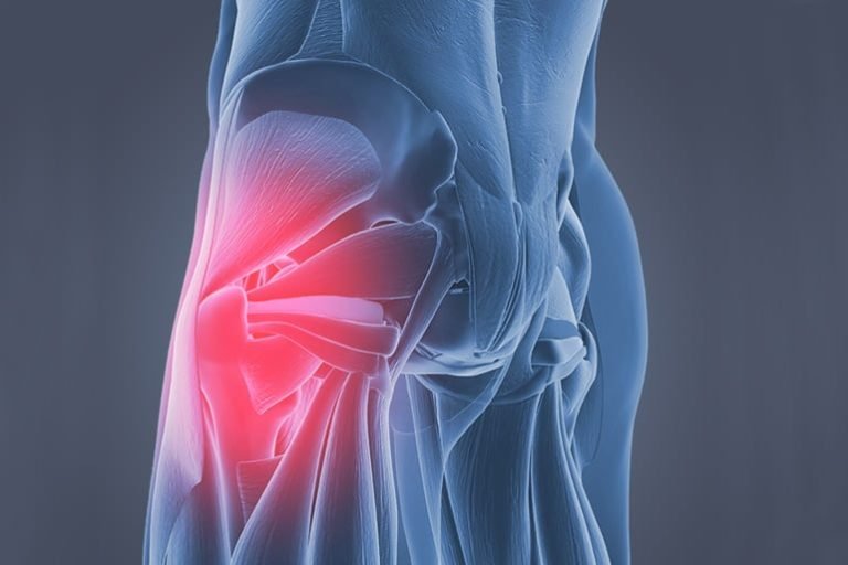 Hip Injury Treatment at Rx Physiotherapy Wollongong